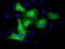 Tubulin Alpha 3e antibody, LS-C115542, Lifespan Biosciences, Immunofluorescence image 