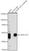 Vasodilator Stimulated Phosphoprotein antibody, GTX66601, GeneTex, Immunoprecipitation image 