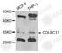 Collectin Subfamily Member 11 antibody, A4955, ABclonal Technology, Western Blot image 