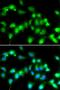 Interferon Regulatory Factor 4 antibody, orb48971, Biorbyt, Immunofluorescence image 