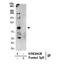 ATPase Sarcoplasmic/Endoplasmic Reticulum Ca2+ Transporting 2 antibody, GTX23625, GeneTex, Immunoprecipitation image 
