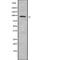 Lon Peptidase 2, Peroxisomal antibody, abx216466, Abbexa, Western Blot image 