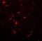 Microtubule Associated Protein 1 Light Chain 3 Beta antibody, A01524, Boster Biological Technology, Immunofluorescence image 