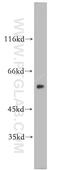 MutY DNA Glycosylase antibody, 19650-1-AP, Proteintech Group, Western Blot image 