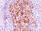 TNF Receptor Superfamily Member 8 antibody, NBP2-29425, Novus Biologicals, Immunohistochemistry paraffin image 