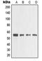 Matrix Metallopeptidase 3 antibody, MBS820802, MyBioSource, Western Blot image 