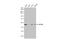 Splicing Factor 3b Subunit 4 antibody, GTX117942, GeneTex, Western Blot image 