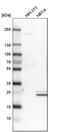 Catechol-O-Methyltransferase antibody, PA5-51523, Invitrogen Antibodies, Western Blot image 