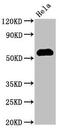 Heat Shock Transcription Factor 1 antibody, CSB-PA010791LA01HU, Cusabio, Western Blot image 