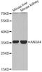 Annexin A4 antibody, A13466, ABclonal Technology, Western Blot image 