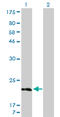 Solute Carrier Family 49 Member 3 antibody, LS-C197733, Lifespan Biosciences, Western Blot image 