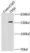VPS8 Subunit Of CORVET Complex antibody, FNab09451, FineTest, Immunoprecipitation image 