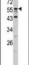 Downstream Neighbor Of SON antibody, PA5-13509, Invitrogen Antibodies, Western Blot image 