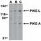 ArfGAP With GTPase Domain, Ankyrin Repeat And PH Domain 2 antibody, NBP1-77194, Novus Biologicals, Western Blot image 