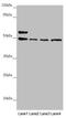 Adaptor Related Protein Complex 1 Subunit Mu 1 antibody, LS-C675381, Lifespan Biosciences, Western Blot image 