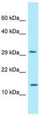 Ribosomal Protein Lateral Stalk Subunit P2 antibody, TA338349, Origene, Western Blot image 