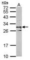 Tetraspanin 3 antibody, PA5-28514, Invitrogen Antibodies, Western Blot image 