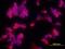 Integrin Subunit Alpha V antibody, NB100-2618, Novus Biologicals, Immunofluorescence image 