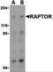 Regulatory Associated Protein Of MTOR Complex 1 antibody, 3493, ProSci, Western Blot image 