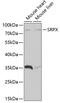 Sushi Repeat Containing Protein X-Linked antibody, GTX64860, GeneTex, Western Blot image 