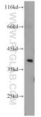 Serine/Threonine Kinase Receptor Associated Protein antibody, 18277-1-AP, Proteintech Group, Western Blot image 
