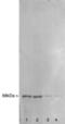Neurofilament Light antibody, LS-B10376, Lifespan Biosciences, Western Blot image 