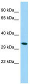 Spermatogenesis Associated 1 antibody, TA334384, Origene, Western Blot image 