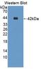 Resistin antibody, LS-C722557, Lifespan Biosciences, Western Blot image 