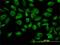 Tubulin Alpha 1c antibody, H00084790-M04, Novus Biologicals, Immunofluorescence image 