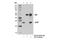 Caseinolytic Mitochondrial Matrix Peptidase Proteolytic Subunit antibody, 14181S, Cell Signaling Technology, Immunoprecipitation image 