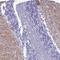 Solute Carrier Family 1 Member 6 antibody, NBP2-48740, Novus Biologicals, Immunohistochemistry frozen image 