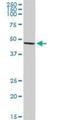 Transforming Growth Factor Beta 1 Induced Transcript 1 antibody, H00007041-D01P, Novus Biologicals, Western Blot image 