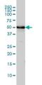 Tubulin Alpha 4a antibody, H00007277-M01, Novus Biologicals, Western Blot image 