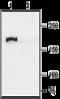 CF Transmembrane Conductance Regulator antibody, GTX54774, GeneTex, Western Blot image 