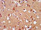 SIM BHLH Transcription Factor 2 antibody, LS-C671138, Lifespan Biosciences, Immunohistochemistry paraffin image 