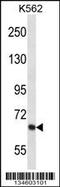 Potassium voltage-gated channel subfamily D member 2 antibody, 58-024, ProSci, Western Blot image 