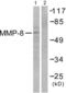 Matrix Metallopeptidase 8 antibody, abx013151, Abbexa, Western Blot image 