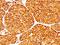 Tyrosinase antibody, NBP2-25238, Novus Biologicals, Immunohistochemistry frozen image 