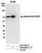 Transcriptional repressor p66-beta antibody, A301-283A, Bethyl Labs, Immunoprecipitation image 