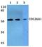 Collagen Type XXVI Alpha 1 Chain antibody, A14262, Boster Biological Technology, Western Blot image 