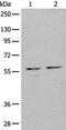 Unconventional prefoldin RPB5 interactor antibody, PA5-67635, Invitrogen Antibodies, Western Blot image 