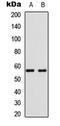 Bone Morphogenetic Protein 6 antibody, LS-C358434, Lifespan Biosciences, Western Blot image 