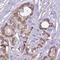 Ran GTPase Activating Protein 1 antibody, NBP2-33591, Novus Biologicals, Immunohistochemistry frozen image 