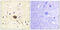 Ras Protein Specific Guanine Nucleotide Releasing Factor 1 antibody, abx012796, Abbexa, Immunohistochemistry paraffin image 