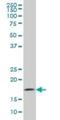 Guided Entry Of Tail-Anchored Proteins Factor 1 antibody, H00007485-M04, Novus Biologicals, Western Blot image 