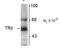 Thyroid Hormone Receptor Beta antibody, TA309257, Origene, Western Blot image 