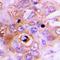 Ferrochelatase, mitochondrial antibody, LS-C667799, Lifespan Biosciences, Immunohistochemistry paraffin image 