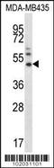 Matrix Metallopeptidase 16 antibody, 62-173, ProSci, Western Blot image 