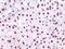 Nucleophosmin 1 antibody, 32-198, ProSci, Immunohistochemistry frozen image 