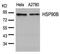 Heat Shock Protein 90 Alpha Family Class B Member 1 antibody, 79-403, ProSci, Western Blot image 